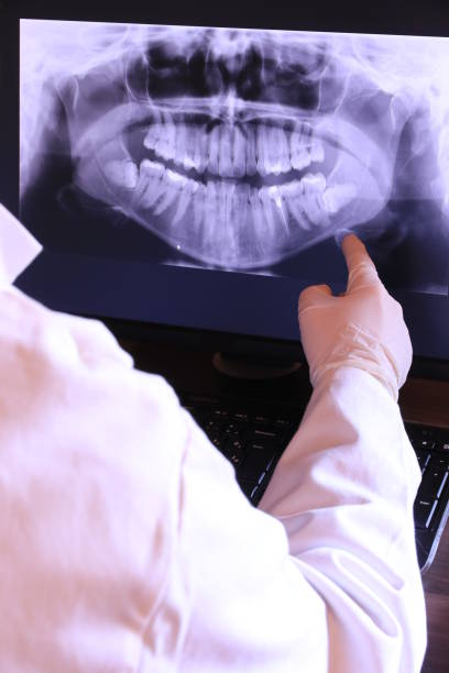 Best Emergency Gum Treatment in Ranlo, NC